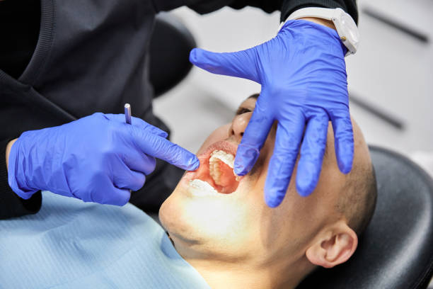 Best Emergency Wisdom Teeth Removal in Estill Springs, TN